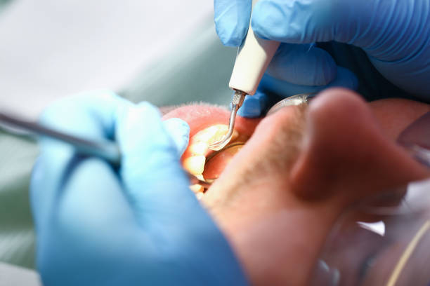 Best Same-Day Emergency Dentist in Edwards, MS