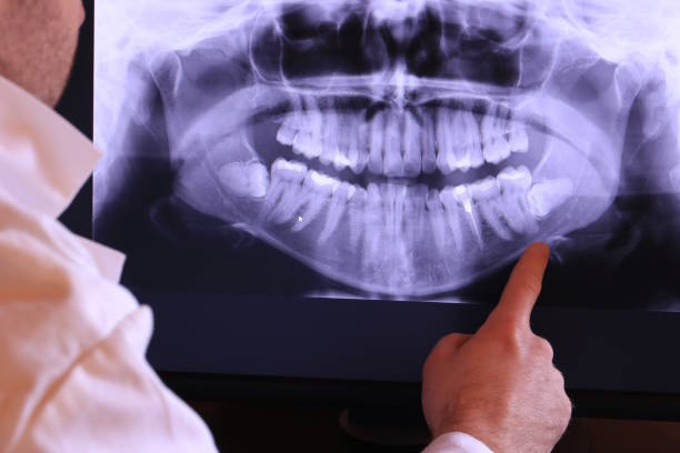 Best Emergency Dental Surgery in Edwards, MS